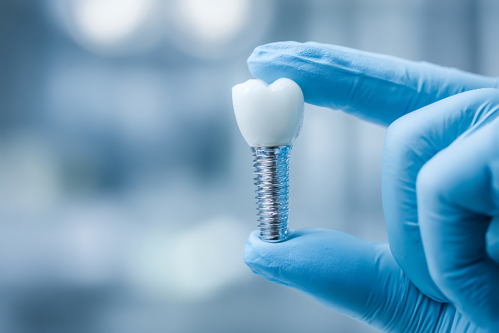 インプラント治療について説明する歯科医師